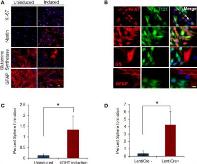 Abrogation of Rb Tumor Suppression Initiates GBM in Differentiated Astrocytes by Driving a Progenitor Cell Program